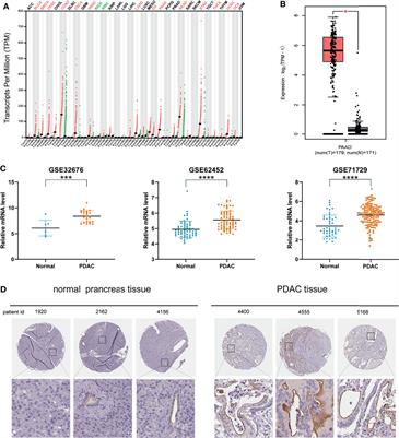 Up-Regulated MISP Is Associated With Poor Prognosis and Immune Infiltration in Pancreatic Ductal Adenocarcinoma